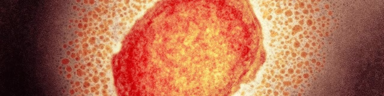 Microsoopbeeld geel-oranje cel middenin rode en lichte cellenpatroon nieuwsoverzicht 23-29 mei 2022 tkkr twente